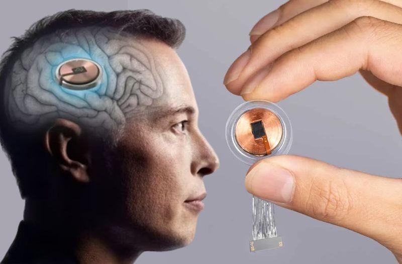 Illustration of a Neuralink brain-computer interface chip beside a hand holding the physical implant, with a brain silhouette shown in profile