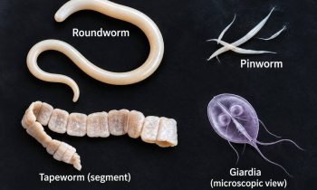 Autism and parasites: chart showing roundworm, pinworm, tapeworm segment and a microscopic view of giardia